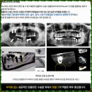 디캐드 덴탈 이미지