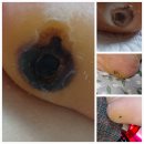 비고르바른건강핫톡 이미지