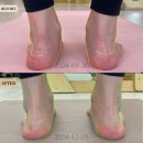 폴인필라테스 - 마포구 마포대로24길 4 | 폴인기구필라테스&PT(화명점)후기🖤 진행중🔥