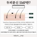 가르마·정수리 SMP 가격, 확실하게 알려드립니다! 이미지