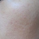 구로프라자온누리약국 | 약국화장품 핫플크림 쥬비렉스 올리고 PDRN크림에 대한 정보 2주간 사용찐후기
