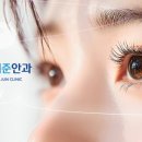 삼성아이준안과의원 네이버블로그