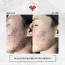 스파더제이