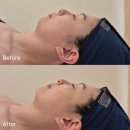 (주)마니커 천안지점 | 천안 불당동 데콜테 에스테틱샵 렛미인스킨랩 내돈내산 1회 후기(수화강테라피)