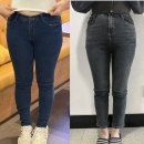 세이멍 | 360도 전체 허벅지지방흡입 한달차 후기 전후 + 붓기, 멍, 바본 정보(세이예스)