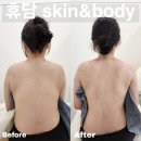 휴담 | 휴담 스킨앤바디 에너지 등 관리 후기💆🏻‍♀️