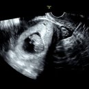 태평산부인과 | 임신 중기 22주 - 성남 태평역에 있 산부인과 솔직후기 (분당차병원 전원)