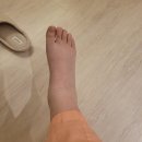 로아맘마 | 제왕절개출산 다리붓기빼기 대구여성아이 산후 조리원 마사지 후기