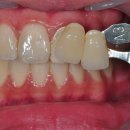 서울귀한이치과병원 이미지