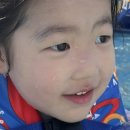 수원에버성형외과의원 | 정자동 한땀성형외과 아이 눈 옆 찢어짐 봉합 후기 비용 흉터 보험