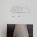 급만성 장염, 설사에 특효혈자리 이미지