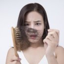 머리나라헤어라인 이미지
