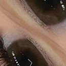 아임메디컬 이미지