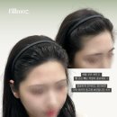 자연스러운 변화, 부산 두피문신 필모즈 부산본점 후기