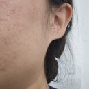 굿화장품 | 임신성 여드름 심할 때 썼던, 지금도 쓰는 화장품 내돈내산 후기