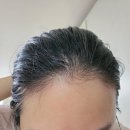 (주)산소피아 | <내돈내산> 나와모샴푸, 나와모울트라부스터 15일차 후기