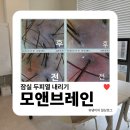 이영빌딩 | 잠실 두피열 내리기 | 모앤브레인에서 두피관리 받고 온 후기