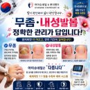 슈네일
