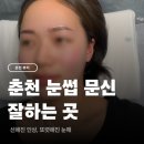 준갤러리 | 춘천 눈썹 문신 M뷰티갤러리 내돈내산 후기, 리터치 과정까지