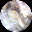 효도보청기 | 천안보청기 효도선물 후기