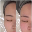 미엘샵 | 상무지구 에스테틱 신부관리샵 미엘 멜로우에서 작은얼굴 윤곽관리 받고 온 후기!