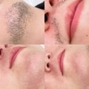 아델라인뷰티 | 대구 남자 수염 왁싱 후기 | '아델라인 뷰티'