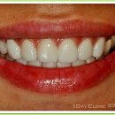 네이치과기공소 이미지