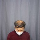 스칼프디자인센터 이미지