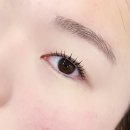 김주봉 | [광주 쌍수 발품 후기] 광주 성형외과 7곳 쌍수 발품 후기