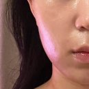 동래 피부관리 요즘 핫한 V윤곽 젯 리프팅 관리 받았어요 윤아에스테틱 안락동 리프팅 추천