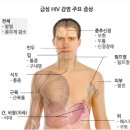 에이즈를 일으키는 바이러스 HIV의 발견 이미지