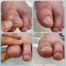 풋솔루션 이미지