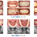 라임치과 네이버블로그