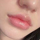 옥수동 | 옥수동 피부과 입술필러 후기 한남동 수입필러 벨로테로