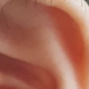 이혈(귀) 상담과 건강관리 이미지