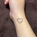 내돈내산 &#39;손목타투 제거&#39; 후기(시술 7회차)