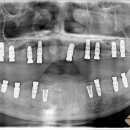 남양치과기공소 이미지