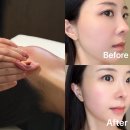 여백이있는날 | 부산 피부관리 스파미우아 해운대점 후기｜해운대 웨딩관리로 얼굴 여백정리 받아본 날