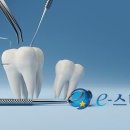 E-스타치과 네이버블로그