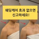 대구웨딩케어 효과, 신랑도 놀란 드라마틱 변신