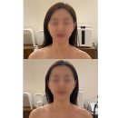 미니스톱 원주구곡한일점 | 원주 윤곽관리는 ? 감자 에스테틱
