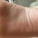 메디레스큐 이미지