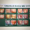 오니크네일 이미지