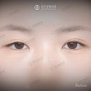 서울라인성형외과의원 이미지