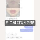 구제라인 | 서면 입술반영구 💋 보라고구마 입술에서 맑은 딸기 입술로 구제된 리얼 내돈내산 후기 (무보정 비포애프터)