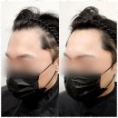 라이모플러스