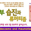 주부 습진에서 류머티즘까지 염증을 치료하는 방법. 이미지