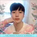 더문성형외과 네이버블로그