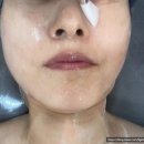동안 | [야탑 피부관리]수리아 에스테틱 스킨 리뉴얼 동안 케어 관리 후기