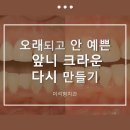 미라치과기공소 | 앞니 크라운 치료 올세라믹 크라운 교체
